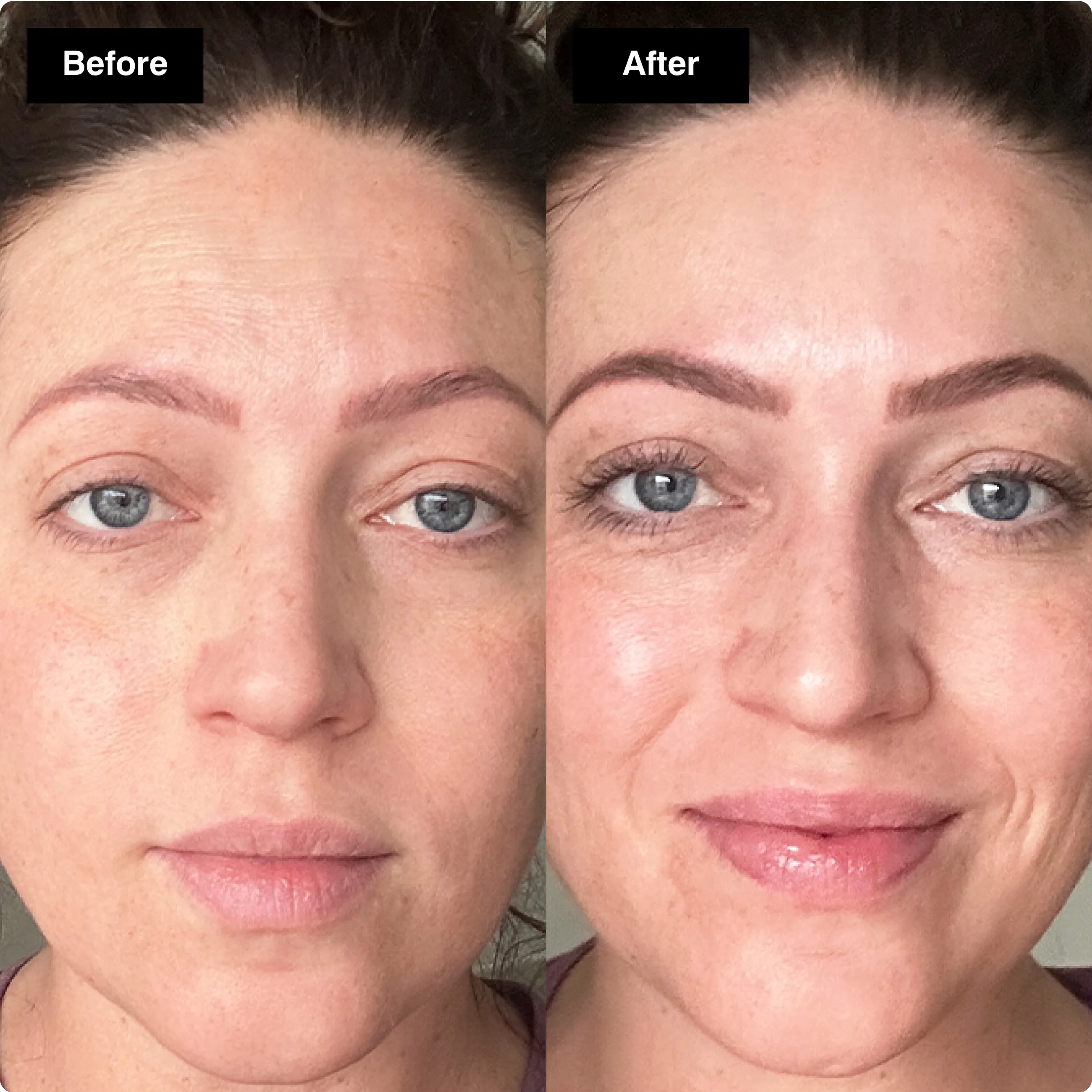 Before and after skincare comparison
showing a brighter facial complexion with
a more radiant, hydrated glow.​