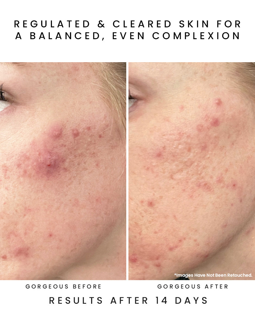 GLOW JUICE 10-Acid Refining Peel - Earth Harbor Naturals