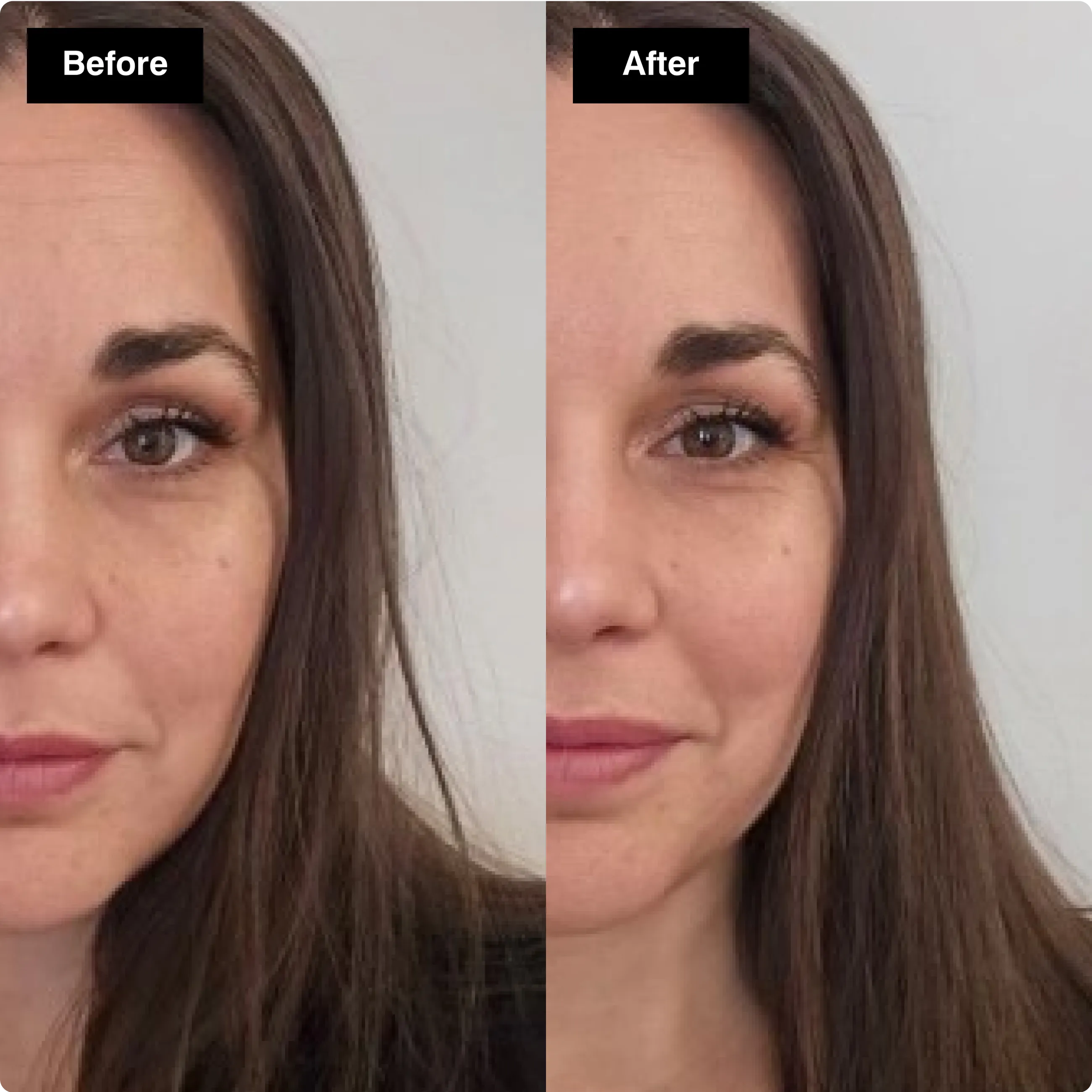 Before and after skincare comparison
showing a clearer and more even facial
complexion.​