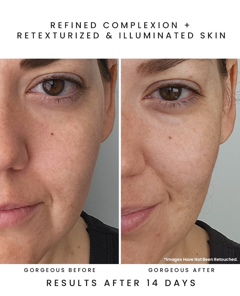 LUNA RAIN 15-Acid Resurfacing Serum - Earth Harbor Naturals