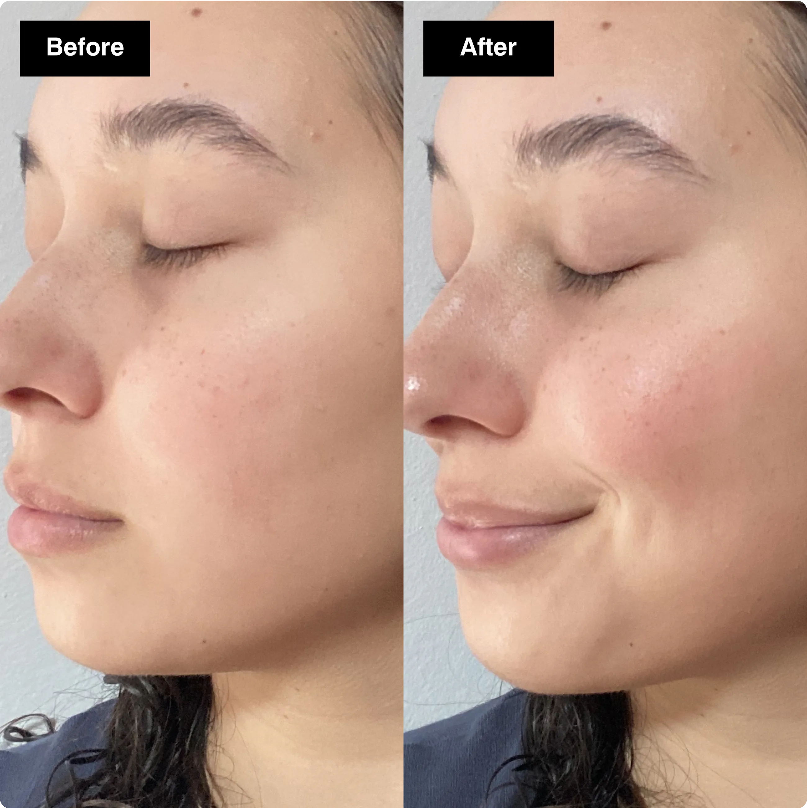 Before and after skincare comparison
showing a side profile with a brighter,
more hydrated, and glowing complexion.​